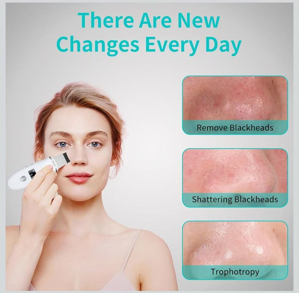 Ultrasonic Skin Scrubber 4-in-1 Deep Cleansing Tool for Pore Extraction