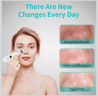 Ultrasonic Skin Scrubber 4-in-1 Deep Cleansing Tool for Pore Extraction